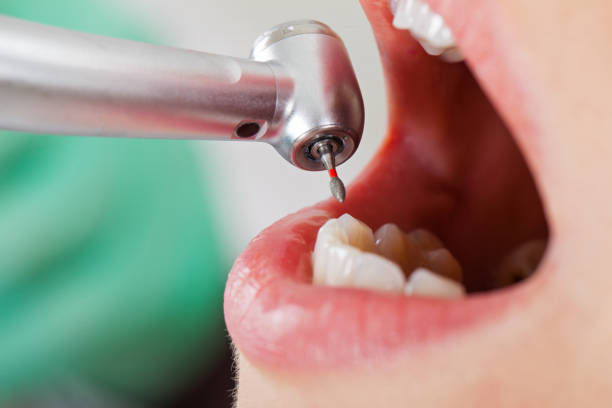 Best Emergency Dental Care for Abscessed Tooth in Conning Towers Nautilus Park, CT